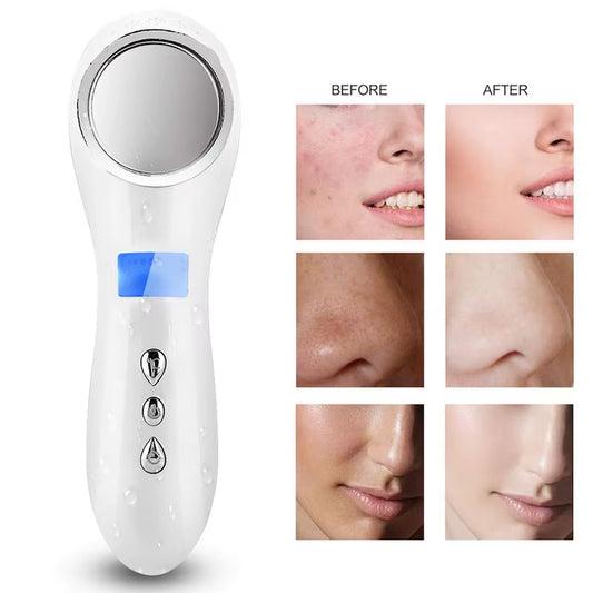 Hot & Cold Facial Lifting Beauty Tool